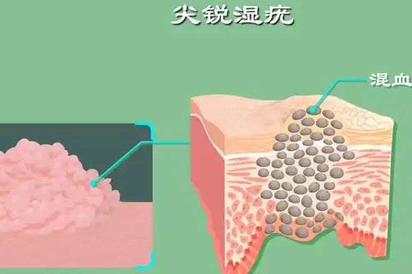 风险预警